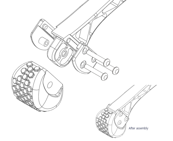 Foot module replacement overview